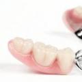 Съемные и несъемные зубные протезы при частичном отсутствии зубов: виды и фото